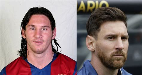 lionel messi height surgery